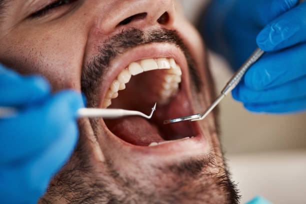 Best Emergency Treatment for Toothache in Mccamey, TX