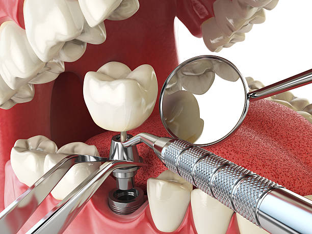 Best Emergency Orthodontic Repairs in Mccamey, TX