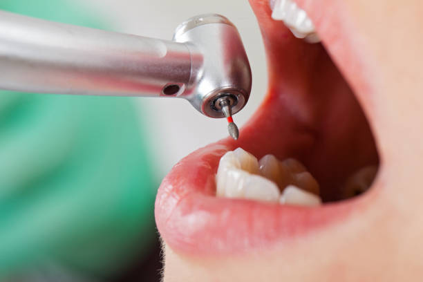 Best Emergency Dental Surgery in Mccamey, TX